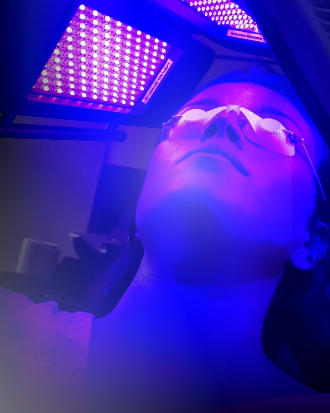 Fototerapia tratamento facial Porto