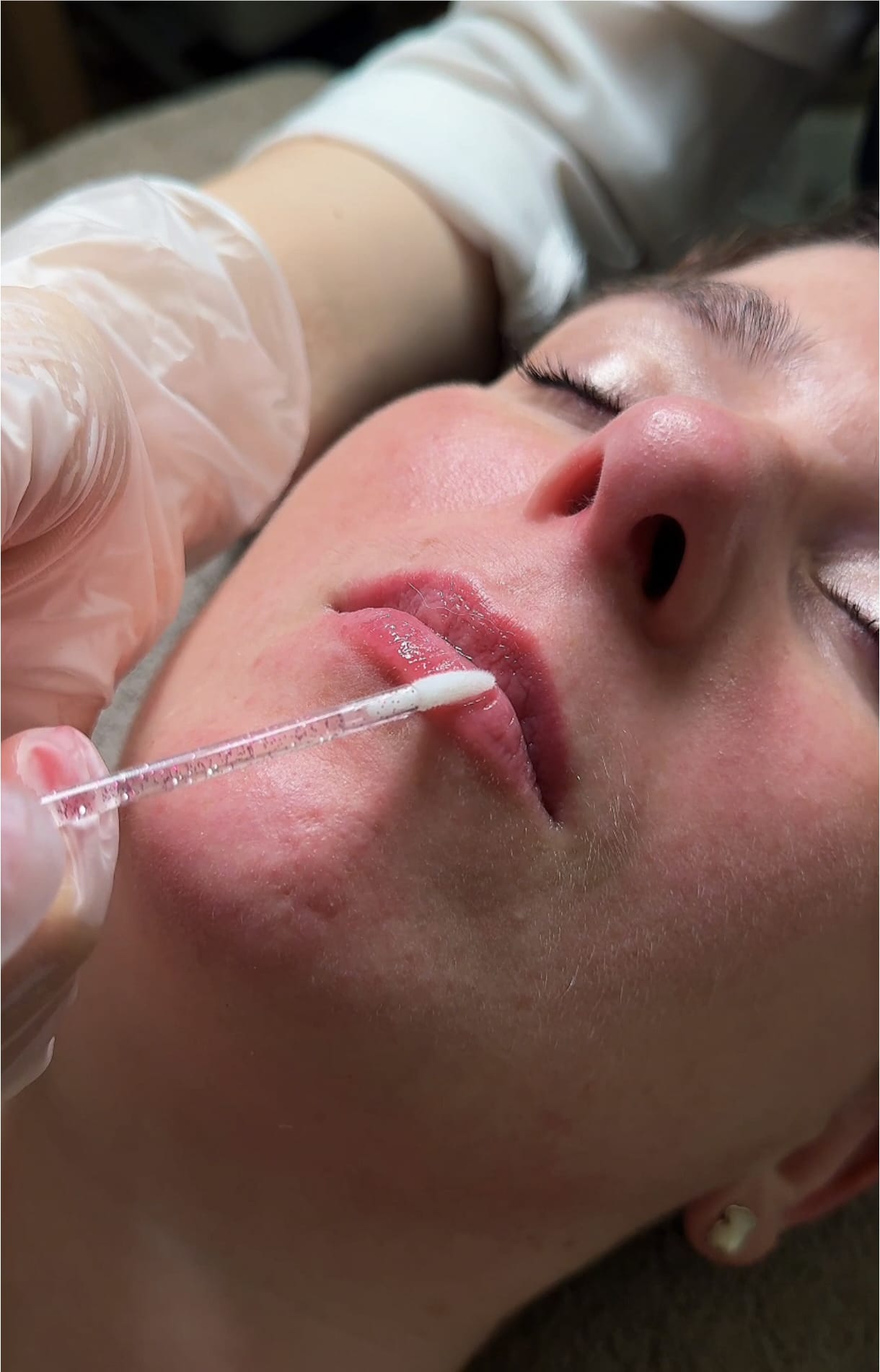 Hydra lips tratamento labial Porto